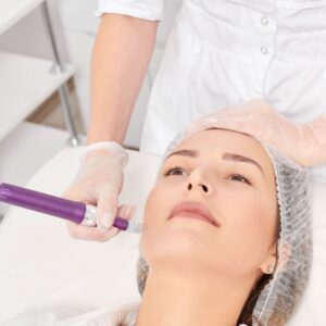 Microneedling semplice