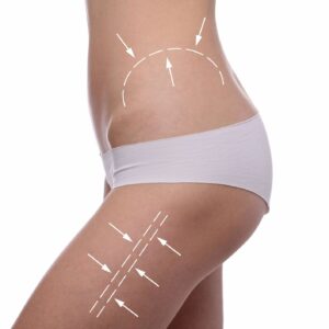 Multiaction slimming
