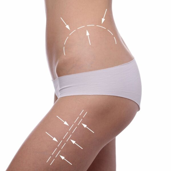 Multiaction slimming