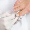 Pedicure curativo