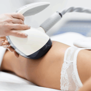 Velashape (2 zone)